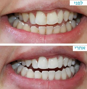 צילום מסך 2025-09-23 181436.png__PID:cad6657c-6f50-44da-a07f-2ccb056d3737