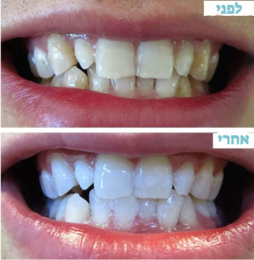 צילום מסך 2025-09-23 181730.png__PID:3c2579d8-f1ae-424b-81dd-54d8120beecb